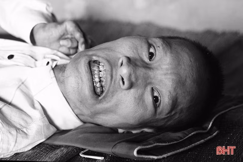 Ám ảnh những nỗi đau da cam ở Hà Tĩnh