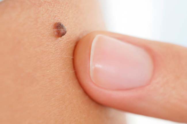 mách bạn một số bài kiểm tra sức khỏe đơn giản tại nhà hình 7 Mách bạn một số bài kiểm tra sức khỏe đơn giản tại nhà