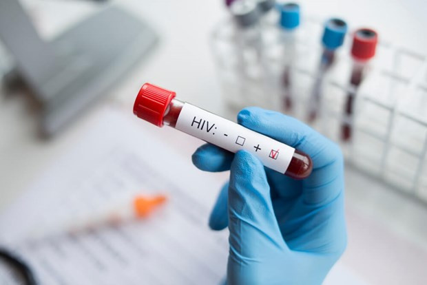 Người phụ nữ đầu tiên khỏi nhiễm HIV sau khi được ghép tế bào gốc hình ảnh 1 Người phụ nữ đầu tiên khỏi nhiễm HIV sau khi được ghép tế bào gốc