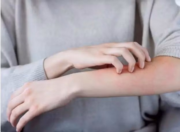 COVID-19 có thể làm phát sinh các biến chứng về da?