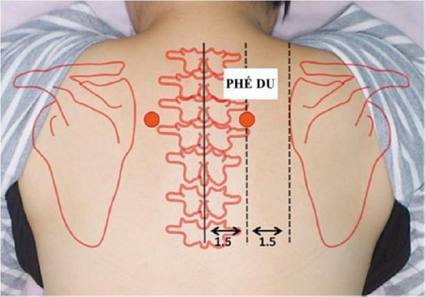 Day ấn 6 huyệt này sẽ giúp giảm viêm họng