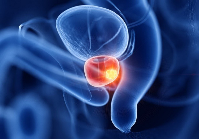 Ảnh minh họa. (Nguồn: Tcimedicine) Ảnh minh họa. (Nguồn: Tcimedicine)
