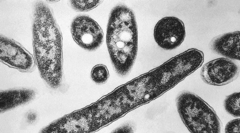 Nguồn gốc của đợt bùng phát bệnh Legionnaires chết người ở Melbourne đã được xác định. Ảnh: AP.