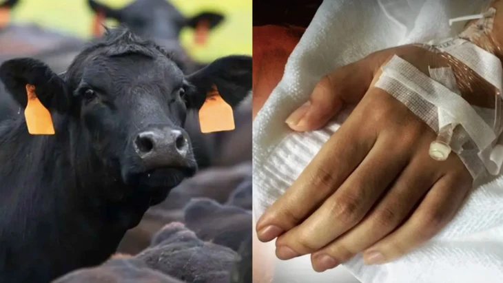 Thái Lan xác định ít nhất 638 người có khả năng bị phơi nhiễm sau khi ăn thịt sống - Ảnh minh họa: THE DAILY GUARDIAN