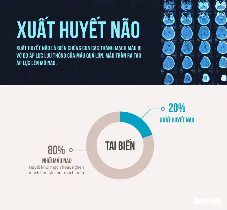 xuat huyet nao khoi diem tu dau