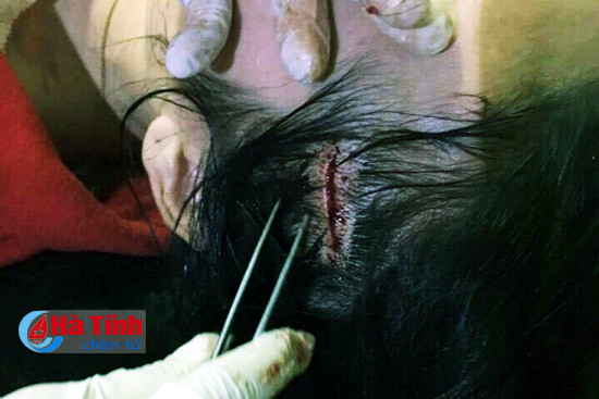 tam dinh chi cong tac nu giao vien hanh hung 1 thieu nu