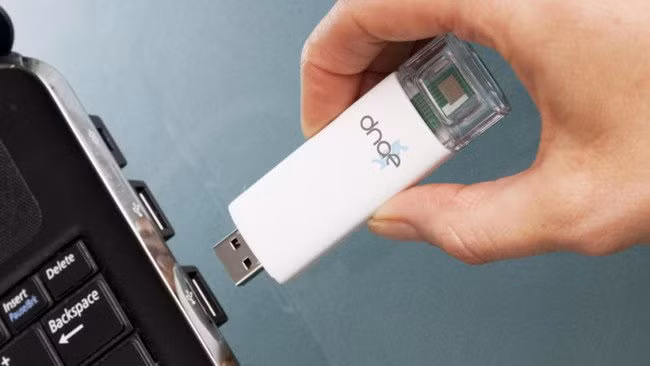 nghien cuu moi xet nghiem hiv bang usb