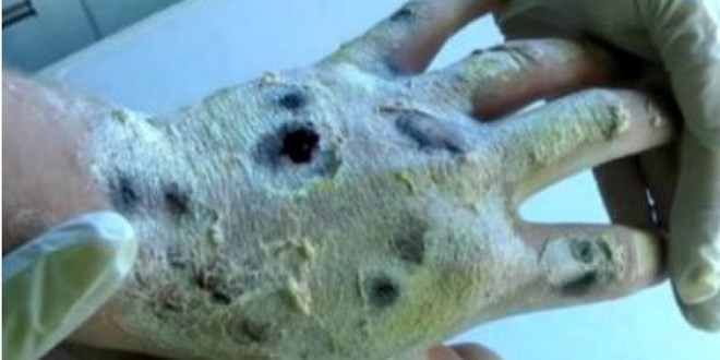 canh bao ve tac hai loai ma tuy ca sau nguy hiem nhat the gioi