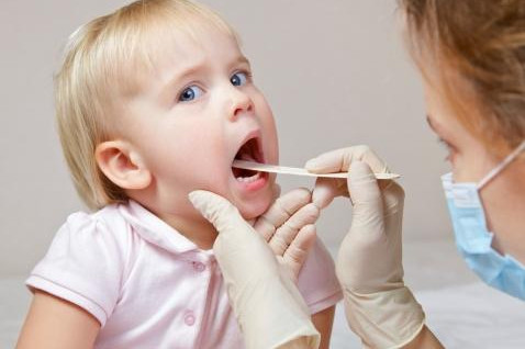 viem amidan bieu hien nhu the nao