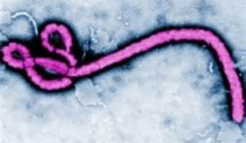 Virus Ebola. Ảnh: Centers for Disease Control and Prevention
