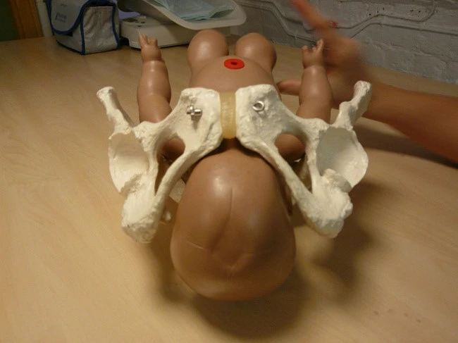 Quan niệm 7: Hông rộng giúp bạn dễ sinh hơn. Hông to hơn phần lớn là do xương chậu - phần lớn và cao nhất của hông. Nhưng trên thực tế, kích thước của xương chậu không liên quan gì đến kích thước của đường dẫn sinh. Yếu tố quyết định ở đây là hình dáng và kích thước của lỗ tròn ở giữa xương chậu. Nó được gọi là đầu vào khung chậu và có thể giống nhau cho dù bạn có hông rất lớn hay rất nhỏ. 8 quan niem sai lam khi mang thai nhieu nguoi van tin