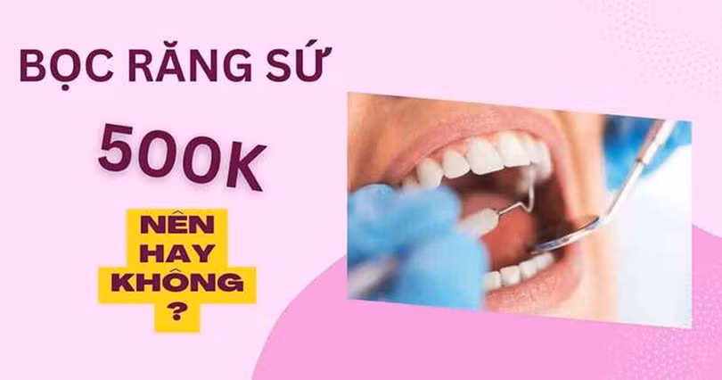Ưu đãi 2.jpg