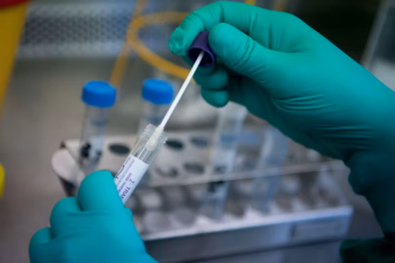 Việc nâng khống giá bộ xét nghiệm COVID-19 là rất nghiêm trọng, cần phải được xử lý nghiêm minh