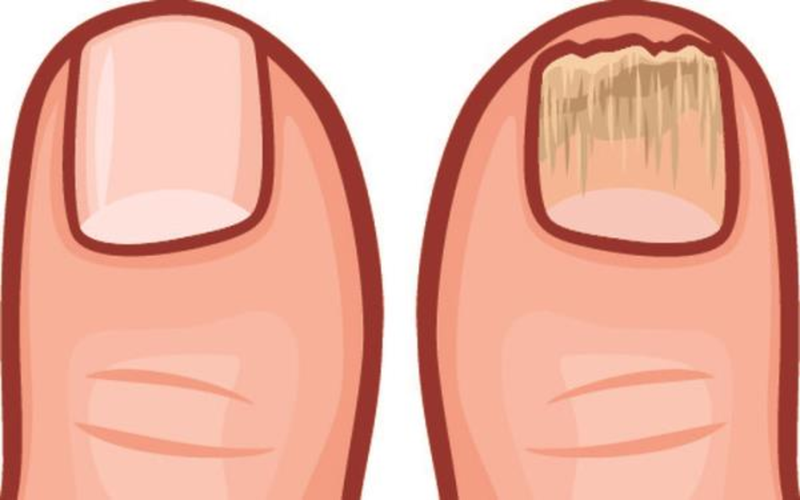 9 dấu hiệu cho thấy cơ thể bạn đang chứa nhiều độc tố