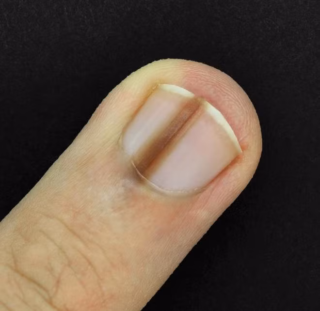 Dấu hiệu bất thường trên cơ thể cảnh báo sức khỏe có vấn đề