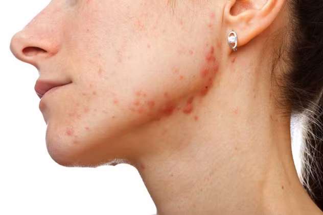 Dấu hiệu bất thường trên cơ thể cảnh báo sức khỏe có vấn đề