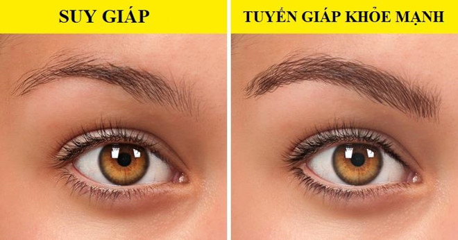 Dấu hiệu bất thường trên cơ thể cảnh báo sức khỏe có vấn đề ảnh 5 Dấu hiệu bất thường trên cơ thể cảnh báo sức khỏe có vấn đề