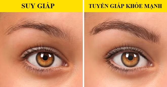 Dấu hiệu bất thường trên cơ thể cảnh báo sức khỏe có vấn đề