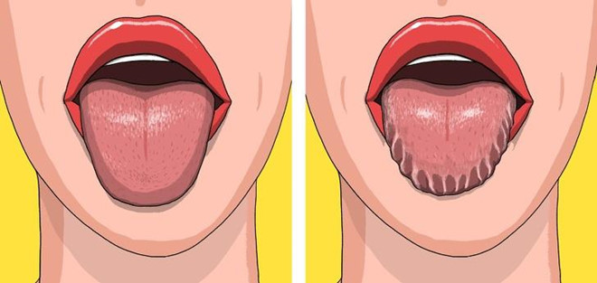 Dấu hiệu bất thường trên cơ thể cảnh báo sức khỏe có vấn đề ảnh 1 Dấu hiệu bất thường trên cơ thể cảnh báo sức khỏe có vấn đề