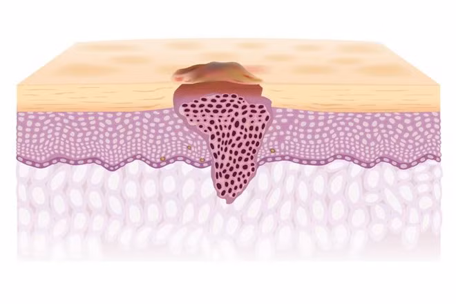 Dấu hiệu bất thường trên cơ thể cảnh báo sức khỏe có vấn đề