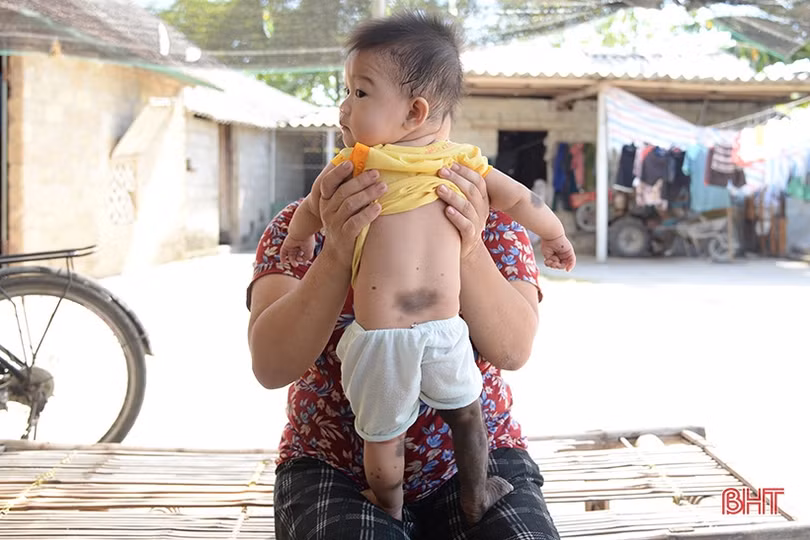 MS 2320: Vợ chồng nghèo bất lực nhìn hai con héo mòn trên giường bệnh