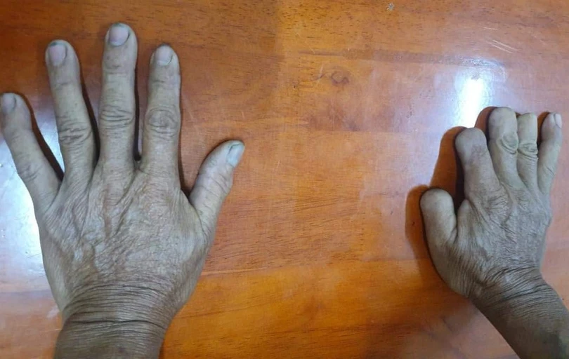 Kẻ giết 6 người bị bắt sau 43 năm trốn truy nã