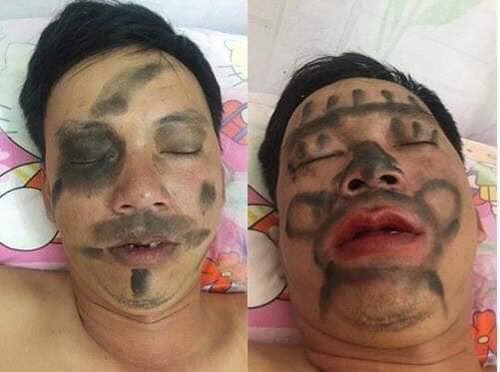 Cách vợ trừng trị chồng say rượu