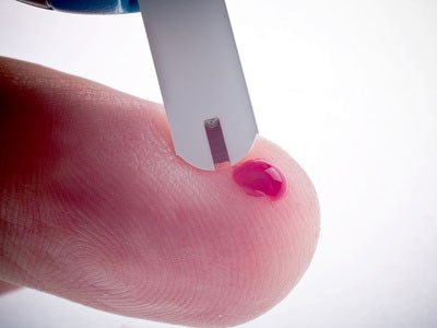 tu xet nghiem hiv tai nha 20 phut co ket qua