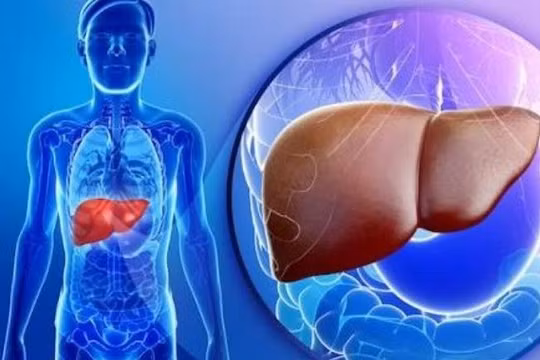 6 cách giúp thanh lọc cải thiện chức năng gan