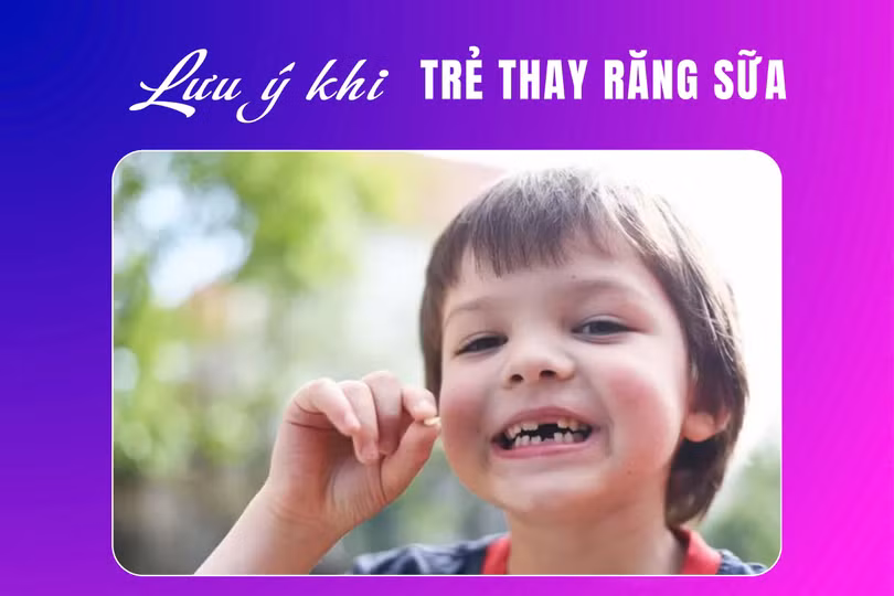 thay răng sữa 2.jpg