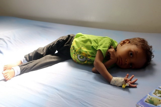 UNICEF lên án việc hơn 2.200 trẻ em bị sát hại ở Yemen ảnh 1 UNICEF lên án việc hơn 2.200 trẻ em bị sát hại ở Yemen