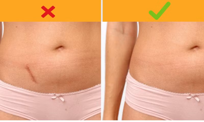 Một số lưu ý để bảo vệ sức khỏe tốt hơn