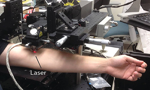 Công nghệ laser tiêu diệt tế bào ung thư