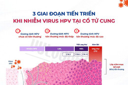 Hướng dẫn sử dụng lọ xịt vulvovagi tăng đào thải HPV cổ tử cung