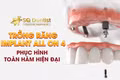 Tiêu xương hàm nặng vẫn trồng được răng nguyên hàm nhờ phương pháp All-on-4