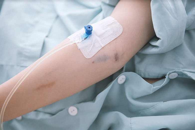Truyền dịch tại nhà, hiện hữu nguy cơ gây sốc