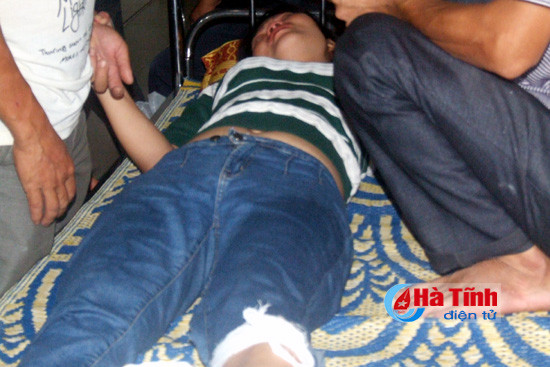 xe buyt dam xe may 1 phu nu bi thuong nang