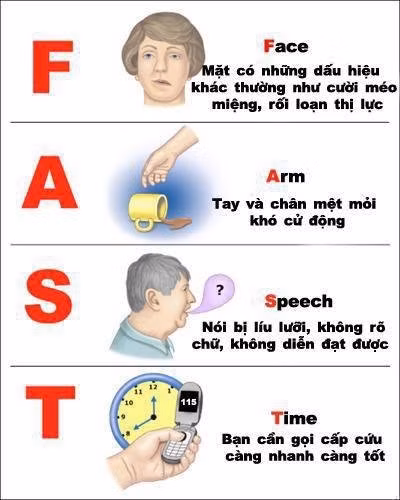 Vì sao trời lạnh dễ đột quỵ?