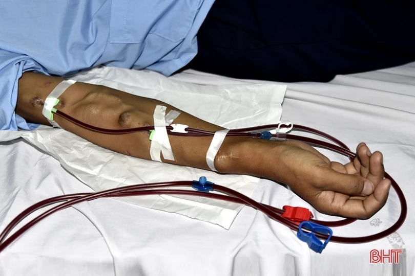 Ca chạy thận cuối cùng của năm tại Bệnh viện Đa khoa tỉnh Hà Tĩnh