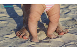 Khi nào cha mẹ cần đưa bé đi khám vì chân vòng kiềng?