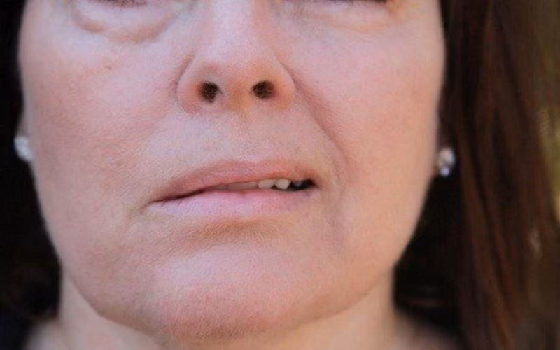 8 dấu hiệu trên khuôn mặt giúp báo hiệu tình hình sức khỏe