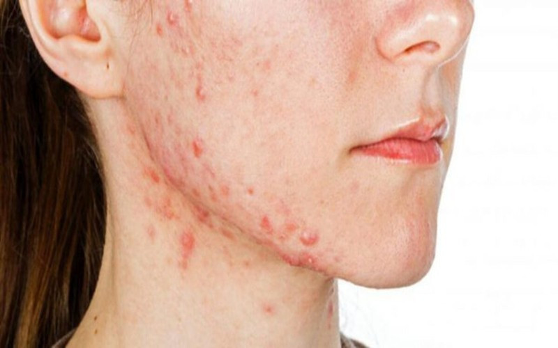 8 dấu hiệu trên khuôn mặt giúp báo hiệu tình hình sức khỏe