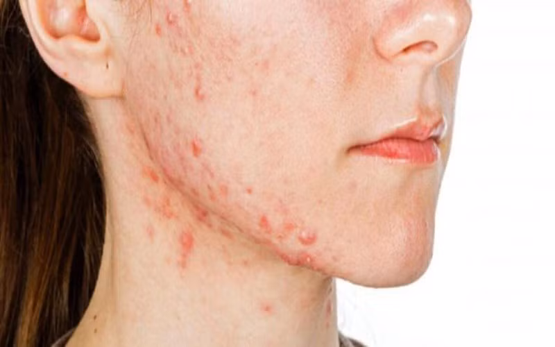 8 dấu hiệu trên khuôn mặt giúp báo hiệu tình hình sức khỏe