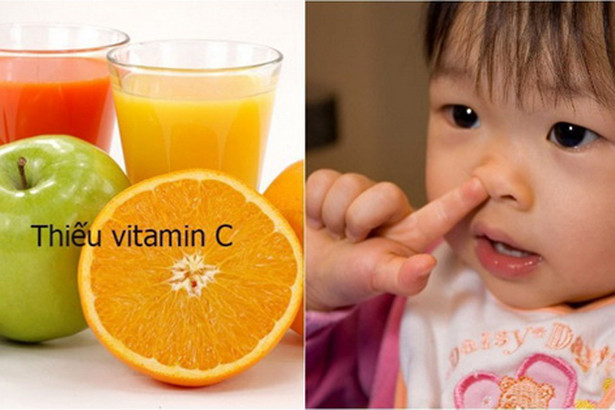 Món ăn - nước uống tốt cho người chảy máu cam ảnh 2 Món ăn - nước uống tốt cho người chảy máu cam