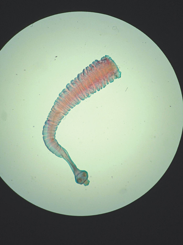 Ăn thịt bò tái, coi chừng sán dây bò! Ăn thịt bò tái, coi chừng sán dây bò!