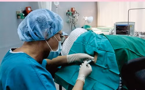 Đề phòng biến chứng trong gây tê tủy sống