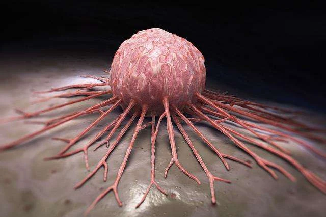 Dù đã được điều trị, tế bào ung thư vẫn có thể phát triển rầm rộ trở lại vì 3 lý do này