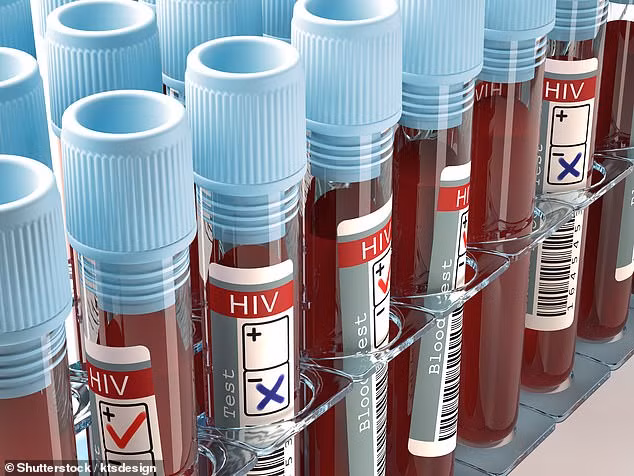 Phát hiện phương pháp làm cho AIDS “hết truyền nhiễm”