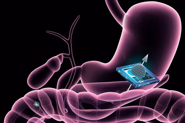 cong nghe microchip moi cho nganh y te trong tuong lai