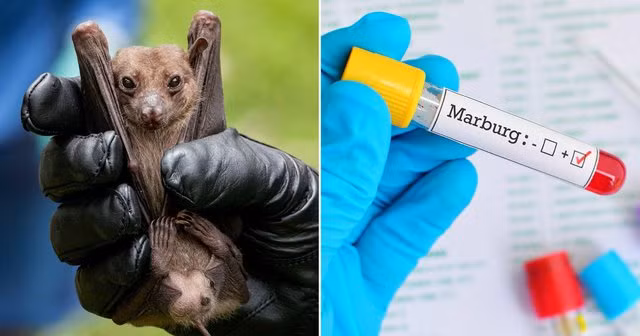 Virus Marburg có nguy hiểm và dễ lây nhiễm không?